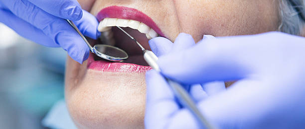Best Knocked-Out Tooth (Avulsed Tooth) Treatment in Highland, UT